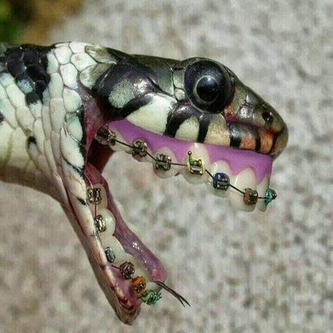 Braces Funny, Funny Snake, Funny Picture, Do Anything, Braces, Funny Animals, Funny, On Instagram