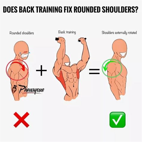 Anatomy Neck, Scapular Winging, Rounded Shoulder Exercises, Scapula Exercises, Dowager's Hump, Fix Rounded Shoulders, Anterior Pelvic Tilt, Shoulder Posture, Tokyo Ghoul Pictures