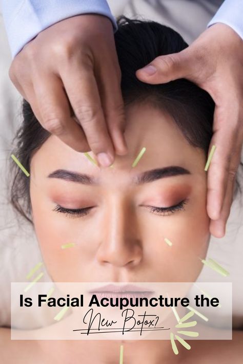 Embrace Youthful Glow! 💫 From fillers to Botox, and now, holistic trends like facial acupuncture. 🌺 Revive your radiance naturally with increased blood flow, plumper skin, and fewer lines. Meet Gudrun Snyder, founder of @moonrabbitacupuncture, sharing all about facial acupuncture's magic. {Click the link!} ✨🌼 Facial Acupuncture, Japanese Medicine, Chinese Healing, Benefits Of Cupping, Muscles Of The Face, Holistic Therapy, Cupping Therapy, Holistic Therapies, Healthier Choices