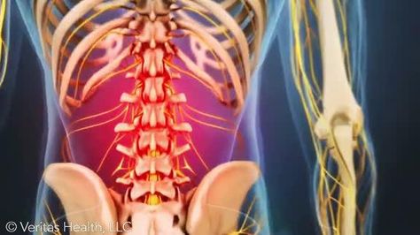 Understanding Different Types of Back Pain Lower Right Back Pain, Pain Management Techniques, Severe Back Pain, Bolesti Chrbta, Middle Back Pain, Sciatica Exercises, Back Pain Remedies, Spine Health, Upper Back Pain