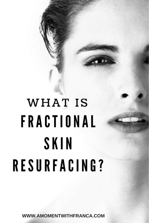 What is Fractional Skin Resurfacing? • Laser resurfacing has enjoyed a recent boost in popularity, as it visibly improves the texture of ageing and acne-prone skin. Read more about fractional skin resurfacing treatments.    #skin #skincare #fractionalskinresurfacing #beauty Fractional Laser, Laser Resurfacing, Skin Care Routine For 20s, Types Of Acne, Skin Resurfacing, Laser Skin, Cosmetic Treatments, Skin Pores, Group Boards