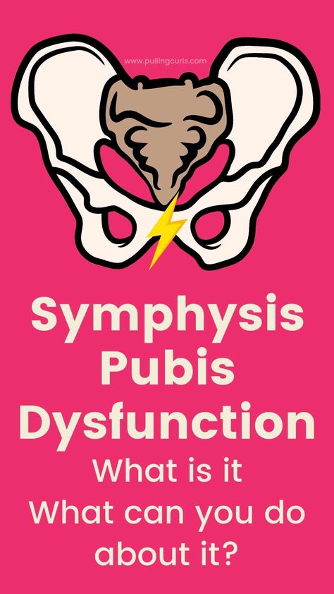 Symphysis Pubis Dysfunction can cause SO many problems for pregnant women and anyone who's ever had a baby). Today we're learing what it is and what we can do help it! via @pullingcurls Pubic Symphysis Dysfunction, Pelvic Girdle, Pelvic Health, Prenatal Classes, Pelvic Organ Prolapse, Female Health, Doctorate, Pelvic Floor Muscles, Pregnancy Health