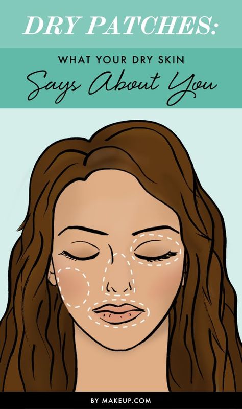 Dry Patches — This Is What Your Dry Skin Might Be Saying About You Nose Peeling, Brown Spots On Skin, Dry Flaky Skin, Dry Skin Remedies, Brown Spots On Face, Combination Skin Type, Skin Patches, Dry Skin Patches, Spots On Face