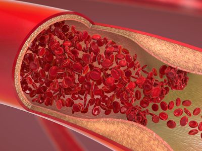 High Ldl Foods To Avoid, How To Lower Ldl Cholesterol, How To Lower Bad Cholesterol, High Cholesterol Diet Shopping Lists, Foods That Lower Cholesterol Fast, Cholesterol Lowering Foods Grocery Lists, Cholesterol Lowering Meals Recipes, High Cholesterol Foods To Avoid List, Lower Ldl Cholesterol Diet