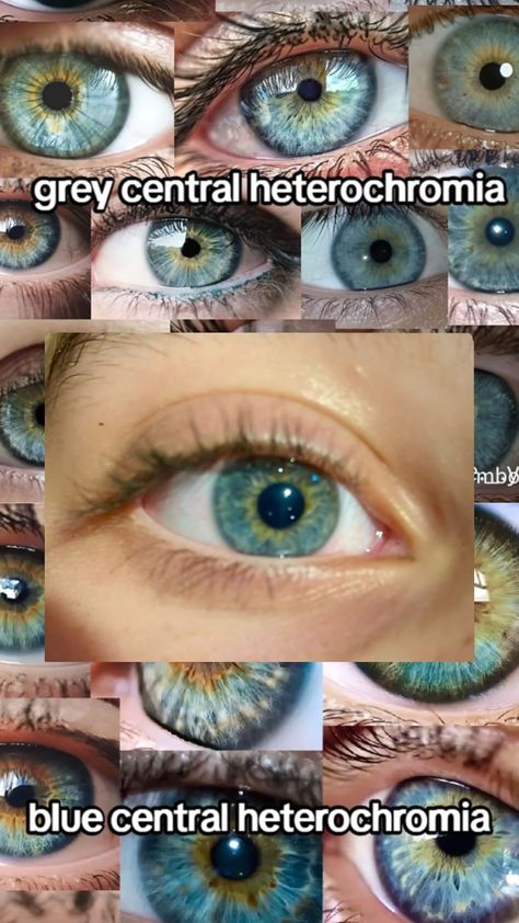 Central Heterochromia Eyes, Central Heterochromia, Pretty Eyes Color, Heterochromia Eyes, Blue Eyes Aesthetic, Rare Eye Colors, Hazel Green Eyes, Eye Color Chart, Rare Eyes