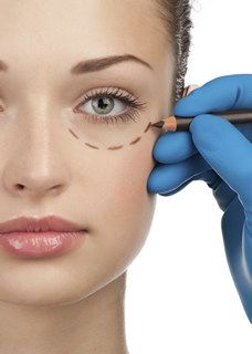 Blephoraplasty Surgery, Saggy Eyes, Bad Plastic Surgeries, Under Eye Fillers, Laser Eye Surgery, Tear Trough, Eyelid Lift, Facial Fillers, Simple Makeup Tips