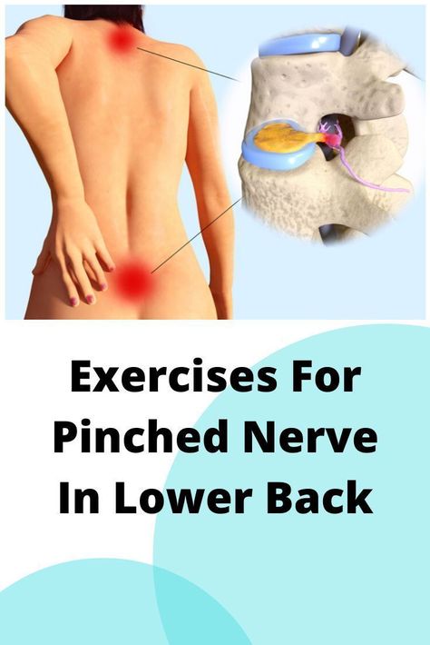 Start your day on the right foot with these easy exercises for a pain-free lower back. Incorporate them into your morning routine for lasting relief. #MorningRoutine #PainFreeLiving Pinched Nerve In Lower Back, Lower Back Pain Causes, Sciatic Nerve Pain Relief, Low Back Pain Relief, Bolesti Chrbta, Back Relief, Sciatica Exercises, Pinched Nerve, Sciatica Pain Relief