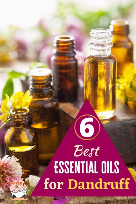 Essential Oils For Dandruff, Dandruff Essential Oil, Natural Dandruff Remedy, Treat Dandruff, Hair Oil Recipe, Diy Hair Oil, Home Remedies For Dandruff, Oils For Dandruff, Essential Oil Beauty