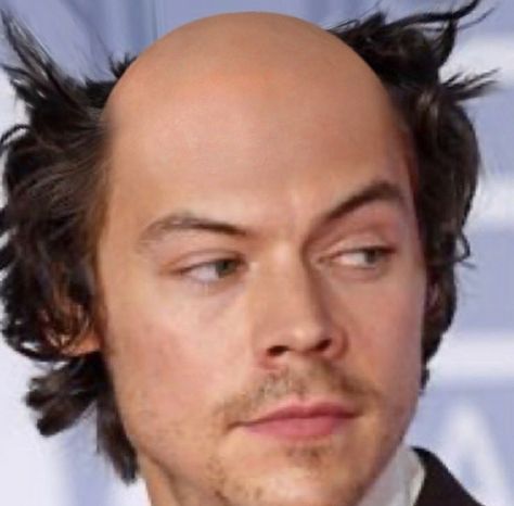 It’s just a bald Harry tf Bald Person Funny, Bald People Funny, Bald Harry Styles, Harry Styles Buzz Cut, Harry Styles In Black, Harry Styles Bald, Bald Aesthetic, Playlist Photos, Bald Person