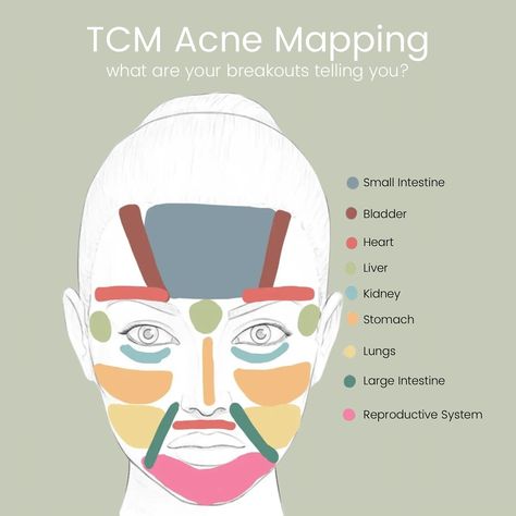 Discover the root cause of your acne with face mapping 👀 Have you ever wondered why you always break out in specific areas like your forehead, chin, or cheeks? According to Traditional Chinese Medicine, the location of your acne can reveal internal imbalances within your body. Forehead: Breakouts here often indicate a dysregulated nervous system. This could be your body’s way of signaling stress or overactivity. Incorporating calming practices like meditation or herbal adaptogens can help ... Breaking Out On Chin, Calming Practices, Dysregulated Nervous System, Tcm Traditional Chinese Medicine, Face Mapping Acne, Acupuncture Clinic, Face Mapping, Health Clinic, Wellness Resources