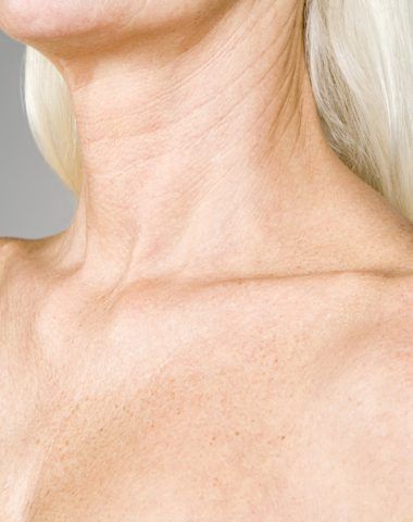 Chest Wrinkle Treatments | Rao Dermatology Chest Wrinkles Remedies, Chest Wrinkles, Regular Skin Care Routine, Neck Wrinkles, Facial Wrinkles, Forehead Wrinkles, Beauty Habits, Best Skin Care Routine, Saggy Skin