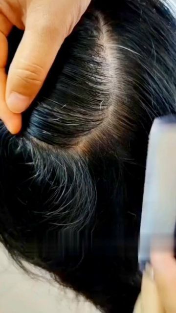 White Hair Solution, Hair Solution, Instagram White, December 27, Hair Solutions, Hair Colour, White Hair, Health And Beauty, Hair Color