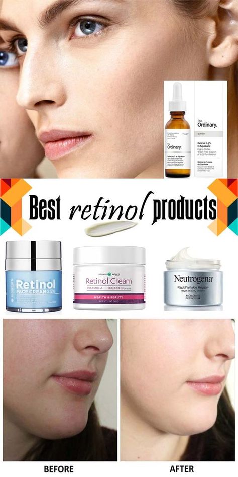 Retinol before and after – Retinol is one ingredient in skincare that prevents premature aging such as wrinkles and fine lines. To slow this down, using retinol products and creams is the right choice.  Aging is a natural process that will happen to everyone. However, it will be sad if it comes earlier than it should. It is commonly said as premature aging. Retinol Skincare Routine, Retinol For Acne, Retinol Benefits, Retinol Products, Retinol Skincare, Anti Aging Skin Care Products, Products For Acne, Womens Skin Care, Drugstore Products