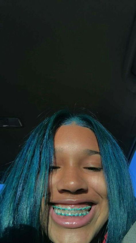 Braces Selfie, Braces Colors, Blue Hair, Braces, Skin, The World, Hair, Blue