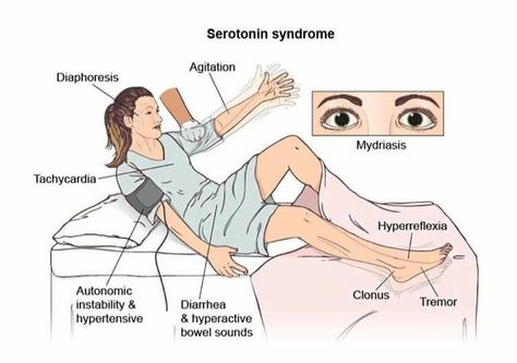 Serotonin Syndrome Nclex Notes, Serotonin Syndrome, Nursing 101, Nclex Pn, Nclex Prep, St John's Wort, Nursing School Tips, Nurse Stuff, Uni Life