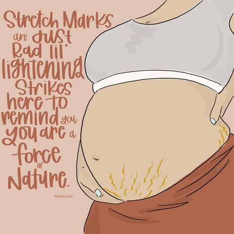 #pregnancyquotes #pregnancy #stretchmarks #stretchmarkspregnant Stretchmarks Quote, Strech Marks, Pregnancy Quotes, Sweet Girls, Body Positivity, Quotes, Instagram