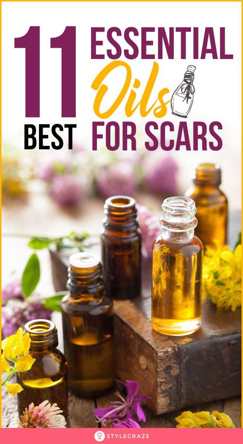 Essential Oils For Healing Skin Wounds, Scar Fading Remedies, Essential Oils For Scar Tissue, Natural Scar Remedies, Essential Oils For Burns On Skin, Essential Oils For Scars After Surgery, Essential Oil For Scars, Scar Healing Essential Oils, How To Fade Scars