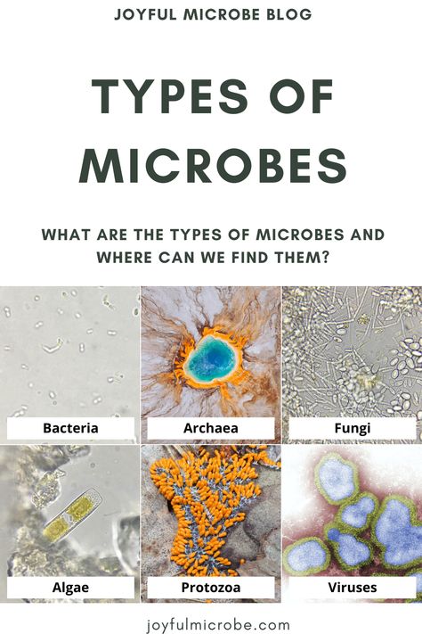 Learn about the different types of microbes, examples of each, and where you can find them in your daily life in my latest post on the blog! #bacteria #archaea #fungi #algae #protozoa #viruses #science #microbiology Microbiology Study, Cells Project, Types Of Fungi, Nursing Mnemonics, Biology Lessons, Cell Wall, Symbiotic Relationships, Hand Hygiene, Medical Knowledge