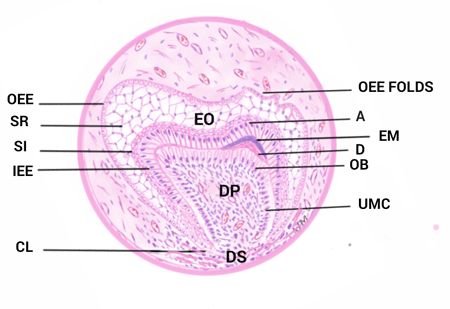 Advanced Bell Stage of Tooth Development. Tooth Development Stages, Hygiene School, Oral Pathology, Oral Maxillofacial, Dental Hygiene School, Case Presentation, Dentistry Student, Dental Anatomy, Human Teeth