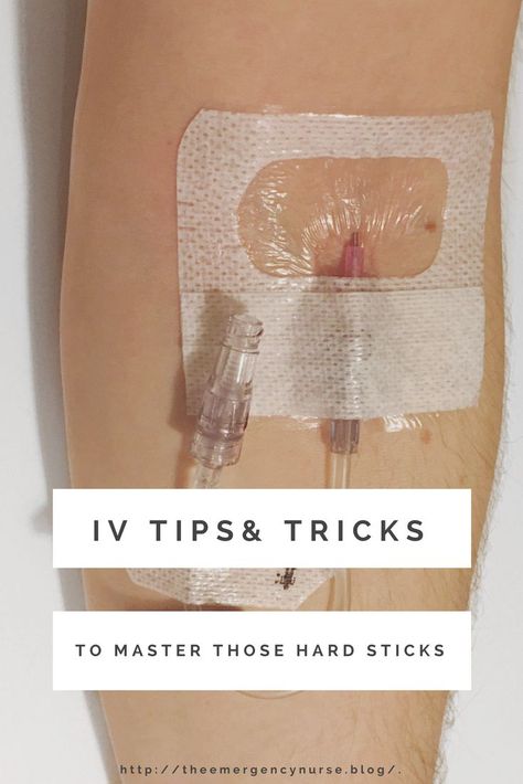 For most new nurses IV starts can be a little daunting, especially if the patient says they are a “hard stick”. So I am sharing all my IV tricks I’ve learned from being in the ER up on the blog! Er Nurse Hacks, Normal Saline Vs Lactated Ringers, Pre Requisites For Nursing, New Nurse Essentials, Nurse Must Haves For Work, Memes Nursing, Nursing Iv, Nursing Procedures, Nursing Pictures