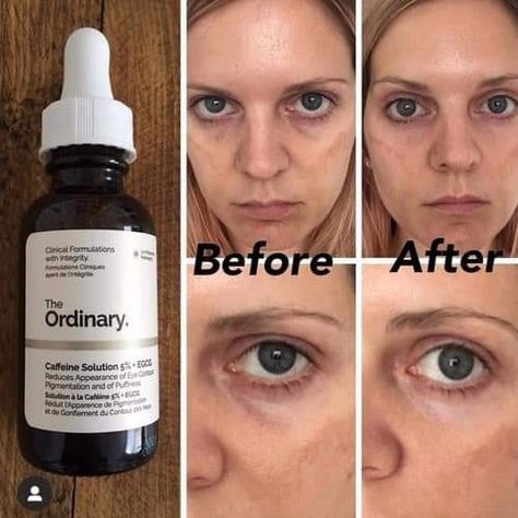 Ordinary Caffeine Solution, The Ordinary Caffeine, The Ordinary Caffeine Solution, Best Serum, روتين العناية بالبشرة, Eye Contour, Body Skin Care Routine, Face Skin Care, Face Serum