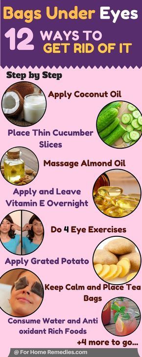 Under Eyes Bags, Eyes Bags, Bags Under Eyes, Dry Eyes Causes, Apply Coconut Oil, Eye Exercises, Under Eyes, Under Eye Bags, Holistic Medicine