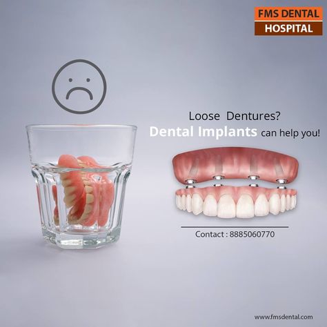 Dental Implant help your Loose Dentures. FMS INTERNATIONAL DENTAL CENTER, JUBILEE HILLS and FMS Dental Hospital, Koti, Hyderabad, are the exclusive Centers for Oral & Maxillofacial Surgery and Dental Implants. Dental Banner, Dental Campaign, Dentist Advertising, Implant Dental, Dental Post, Dental Ads, Tooth Implant, Maxillofacial Surgery, Dental Advertising