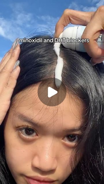 Minoxidil Before And After Women, Dht Blockers, Hair Growth Tips, Hair Transformation, About Hair, Hair Growth, Hair Hair, Hair Care, Hair Cuts