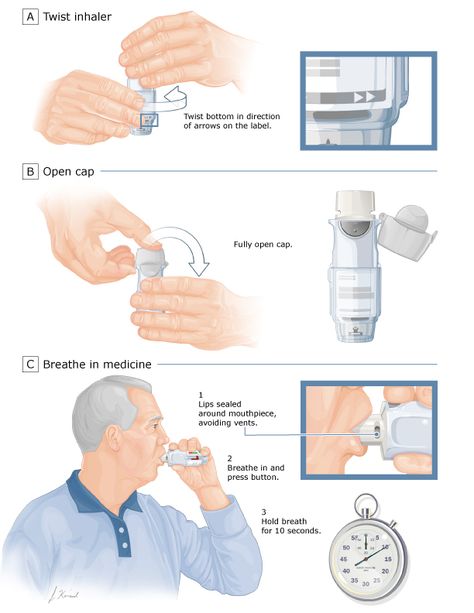 Patient education: Inhaler techniques in adults (Beyond the Basics) - UpToDate Inhaler Design, Asthma Inhaler, Chronic Obstructive Pulmonary Disease, Pulmonary Disease, Patient Education, Breath In Breath Out, The Basics, Disease, Education