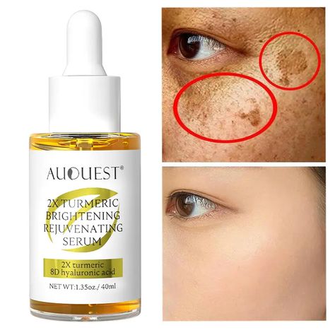 Dark Spot Removal, Turmeric Facial, Turmeric Oil, Vitamin C Face Serum, Serum Facial, Collagen Facial, Remove Dark Spots, Face Skin Care, Face Serum