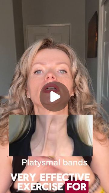 Platysma Muscle Exercise, Neck Massage Techniques, Platysmal Bands, Face Massage Techniques, Sagging Neck, Muscles Of The Face, Neck Muscles, Natural Face Lift, Band Exercises