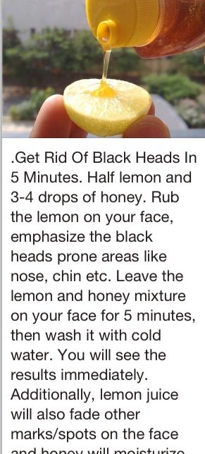 Black Heads, Astuces Diy, Home Health Remedies, Acne Remedies, Health Knowledge, Skin Care Remedies, Skin Care Recipes, Body Skin Care Routine, Diy Skin Care