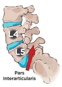 Stenosis Of The Spine, Lumbar Spondylosis, Spine Problems, Severe Back Pain, Lumbar Pain, Back Ache, Middle Back Pain, Lower Back Pain Exercises, Back Pain Remedies