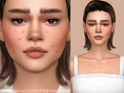 Sims 4 Cc Skin Details, The Sims 4 Skin, Sims 4 Anime, Pimples On Face, Skin Details, Sims 4 Body Mods, Sims 4 Cc Skin, Body Acne, Sims 4 Toddler