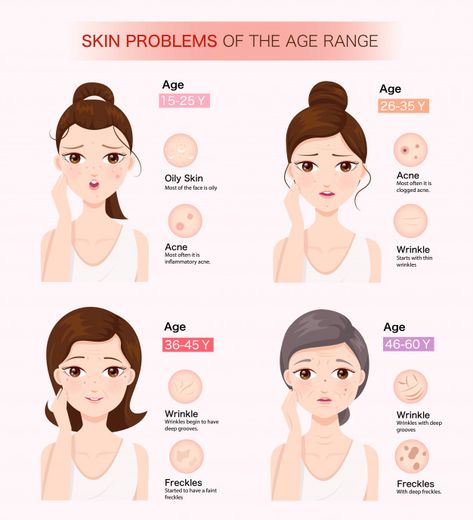 Skin problems of the age range Premium V... | Premium Vector #Freepik #vector #woman #cartoon #pink #beauty Skin Therapist, Natural Acne Remedies, Skin Diseases, Skin Tips, Better Skin, Skin Tightening, Skin Care Essentials, Skin Rejuvenation, Skin Problems