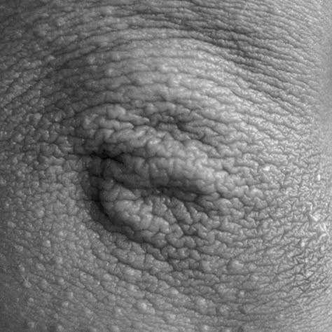 Abstract black-and-white photographs depict beauty in the human body - Contented Imperfection Photography, Human Body Photography, Human Skin Texture, Close Photography, Body Art Photography, Photography Themes, Shotting Photo, Body Photography, Image Nature