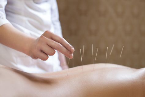 Latest Acupuncture Techniques Show Improvement in Fibromyalgia Acupuncture Benefits, Acupuncture Clinic, Thai Massage, Sciatica, Knee Pain, Chinese Medicine, Acupressure, Neck Pain, Chiropractic