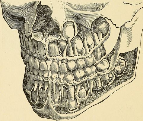 Image from page 37 of "The teeth in health and disease" (1902) | by Internet Archive Book Images Medical Drawings, Teeth Art, Dental Art, The Teeth, Human Anatomy Art, Medical Art, Human Skull, Anatomy Drawing, Scientific Illustration