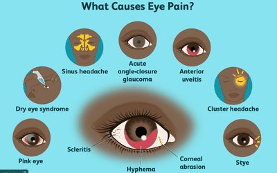 Corneal Abrasion, Eye Medicine, Computer Vision Syndrome, Eye Pain, Blurry Vision, Sore Eyes, Light Sensitivity, Vision Problems, Natural Cold Remedies