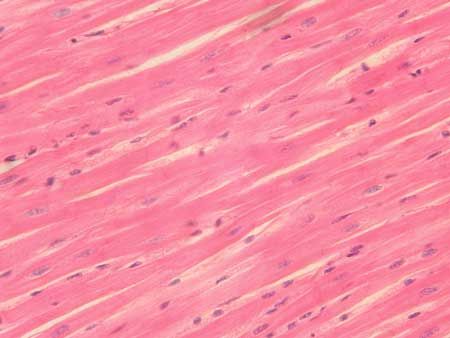 Cardiac muscle Cardiac Muscle Tissue, Cardiac Muscle Cell, Gap Junction, Cardiac Muscle, Histology Slides, Uni Room, Human Anatomy And Physiology, Skeletal Muscle, Molecular Biology