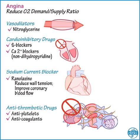 Taking Pharm? Our tutorials, quizzes, and exercises make it easier to learn high-yield concepts, faster. https://drawittoknowit.com/course/cardiovascular-system/glossary/pharmacology/cardiovascular-pharmacology-drug-summary #clinicalpharmacy #pharmacystudents #ditki #usmle #pharmacology #meded #medschool #medstudent #highered #mededonline #usmletutorials #pharmschool #nursing #pance #physicianassistant #osteopath #allopath #medicine #science #healthscience #nurse #premed Cardiovascular Pharmacology, Cardiac Sonography, Doctor Medicine, Cardiovascular Disorders, Note Taking Tips, Pharmacy School, Nursing School Tips, Medical School Studying, Pre Med