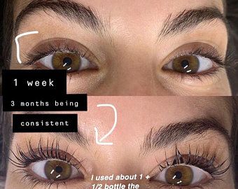 Relentless by Cloudallie on Etsy Natural Eyelash Growth, Eye Makeup Cosmetics, Lash Growth Serum, Eyebrow Serum, How To Grow Eyelashes, Eyelash Growth Serum, Eyelash Serum, Lash Serum, Eyelash Growth