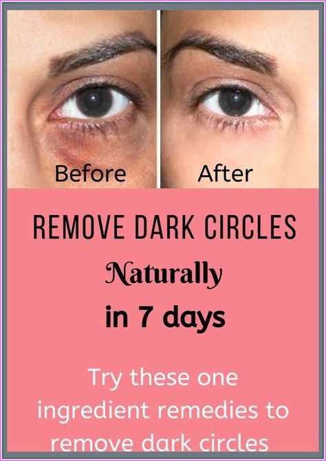 Remove Dark Circles, Under Eyes, Dark Circles Under Eyes, Word Online, Creating A Newsletter, Years Younger, Health And Fitness Tips, Dry Brushing, Dark Circles