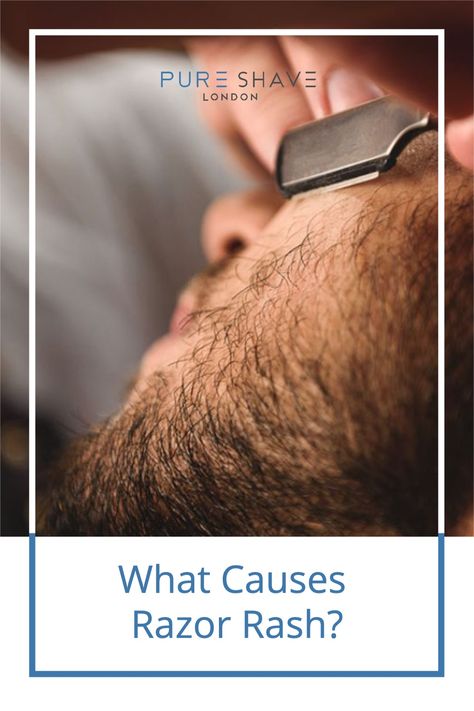 Nothing ruins a good shave like the itchy, irritated, bumpy rash that too often follows – we’ve all been there. But while some of the causes of razor burn are down to user error, more often than not it’s actually the razor and the skincare products you’re using that are creating the issue. #pureshave #shavingtips #mensshavingcream #womensshavingcream #razorrashremedy Razor Burn, How To Avoid Razor Bumps After Shaving, Prevent Razor Burn, Razor For Shaving, Rashes Remedies, Mehrunes Razor, Mens Shaving Cream, Shaving Tips, Best Shave