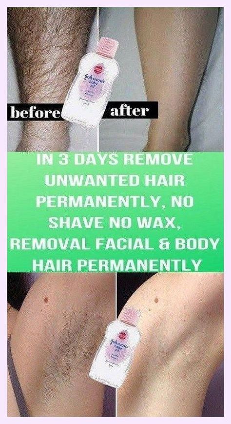 I’m so grateful I get to be here. Laudable info! Best Permanent Hair Removal, Electrolysis Hair Removal, Hair Removal Spray, Unwanted Hair Permanently, Best Hair Removal Products, Remove Unwanted Hair, Underarm Hair Removal, Painless Hair Removal, Unwanted Facial Hair