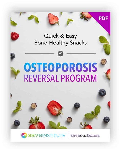 lot Reverse Osteoporosis, Bone Healing Foods, Bone Health Exercise, Dowager Hump, Calcium Foods, Food For Strong Bones, Osteoporosis Diet, Osteoporosis Exercises, Osteoporosis Prevention