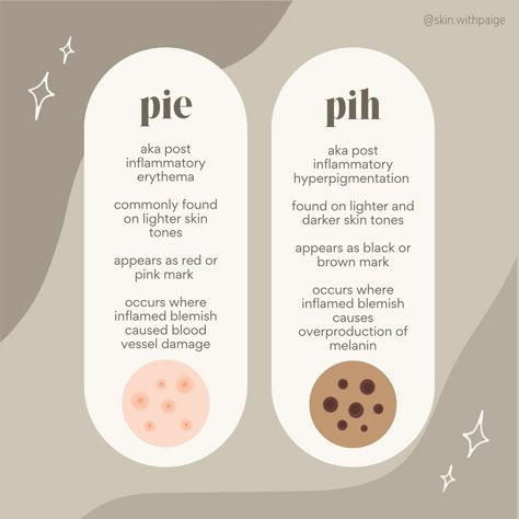 if you’ve ever heard your esthie bestie talking about PIE or PIH, this is what they are referring to! 🐆 this pigmentation shows up on the skin commonly after acne breakouts, but can occur after any inflammation like sun damage, not following post procedure care instructions, and trauma to the skin. depending on your skin tone, one or the other, (or both!) may make an appearance on the skin. if you have post inflammatory erythema or hyperpigmentation, schedule a consultation with me and we... Skin Pigmentation Disorders, Acne Awareness Month, Acne Representation, Acne Pit Scars, Post Inflammatory Hyperpigmentation Acne, Skin Facts, Acne Breakout, Lighter Skin, Show Up