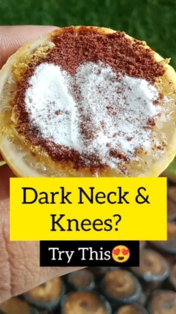 Dark Spots On Neck, Dark Neck Remedies, Dark Neck, Feet Pedicure, Vegan Probiotics, Multani Mitti, Foot Pedicure, Tan Removal, Dark Underarms