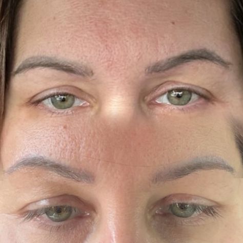 UNDO your old brows! This is just ONE SESSION of saline removal 😍 and WOW! The results speak for itself! •If you’re tired of your old permanent makeup, let’s start fresh with a removal of those old brows and lets make magic happen 🫶🏼✨ My beautiful client Noel, had been unsure for a while on getting them removed or just getting them tattooed over her old microblading. I suggested a removal because her brows were heavily saturated in pigment and the shape she was given was not right for her... Saline Tattoo Removal, Tattoo Removal, Permanent Makeup, Microblading, Let It Be, Tattoos, Makeup, Quick Saves, Make Up