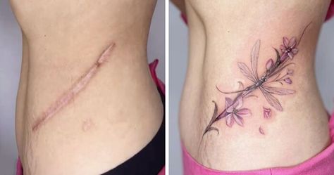 50 Times People Asked To Cover Up Their Scars, And This Tattoo Artist Nailed It (New Pics) | Bored Panda Neck Scar Tattoo Cover, Neck Scar Tattoo, Tattoos Covering Scars, Tattoo Scar Cover, Scar Cover Up Tattoo, Neck Scar, Tattoo Scar, Tattoo Over Scar, Arm Bones